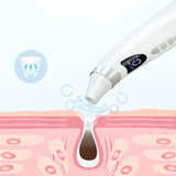 Electric Visual Blackhead Suction Instrument For Skin Care