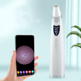 Electric Visual Blackhead Suction Instrument For Skin Care