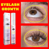 Natural Eyelash Growth Serum - Fast Eyelashes Enhancer