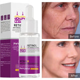 Retinol Wrinkle Remover Serum | Anti-Aging Korean Skincare